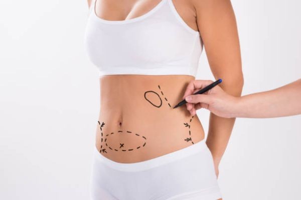 How Body Contouring Addresses Loose Skin and Excess Tissue