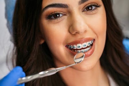 Dental Implants for Missing Teeth: Benefits, Cost & Procedure