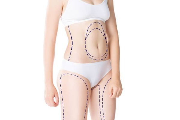Liposuction Treatment Considerations for Natural-Looking Results
