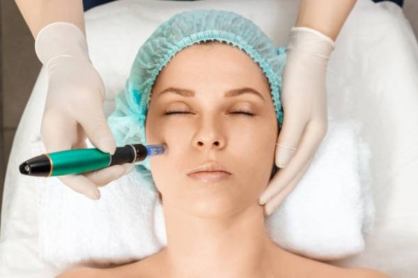 Dermapen for Fine Lines, Pores, and Skin Texture