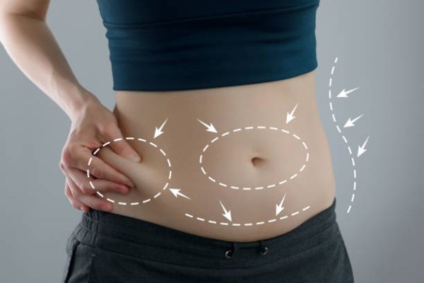 Tummy Tuck Surgery and the Importance of Proper Patient Preparation