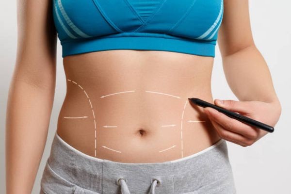 Liposuction in Riyadh: Body Contouring vs Weight Reduction